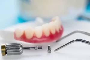 saskatoon-dentist-brightside-dental-clinic-services-2-1024x683.jpg